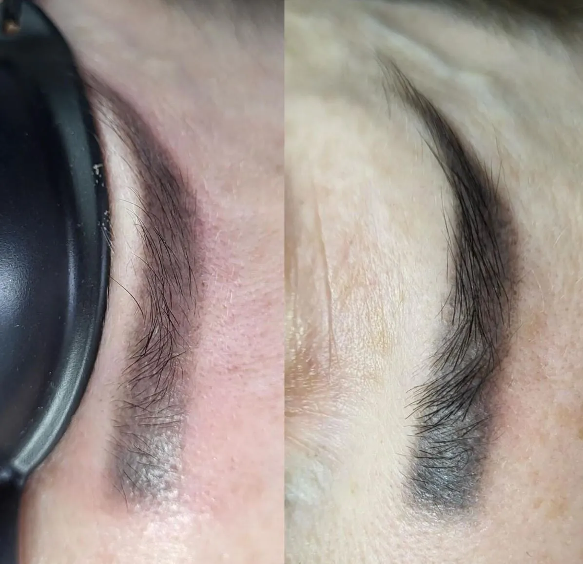 tattoo eyebrow removal